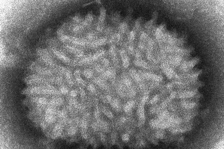 Поксвирус под микроскопом