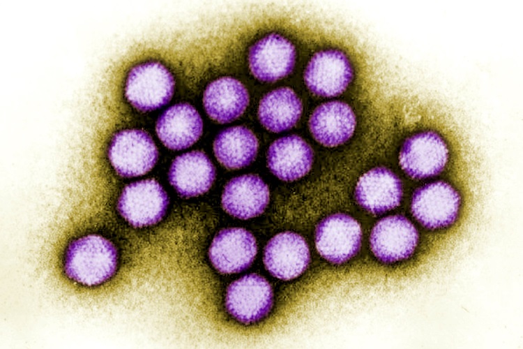 Заболевание аденовирусный конъюнктивит под микроскопом