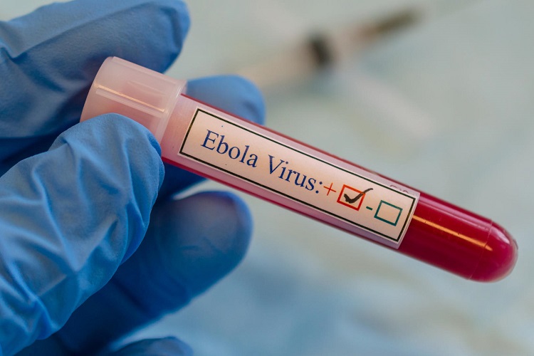 Положительный анализ на Эболу