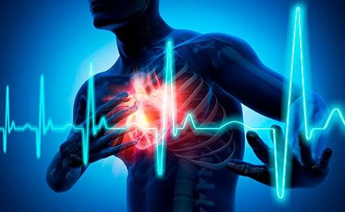 Ункария томентоза или Кошачий коготь (Cat's claw) - целебная сила Уна де Гато (Una de Gato)