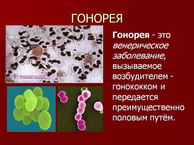 Заражение гонореей Как передается гонорея
